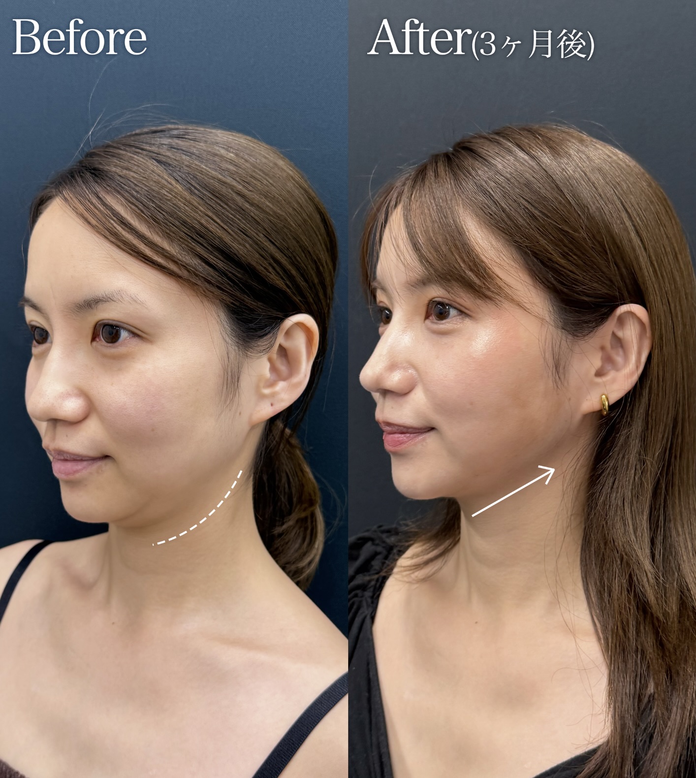 30代女性