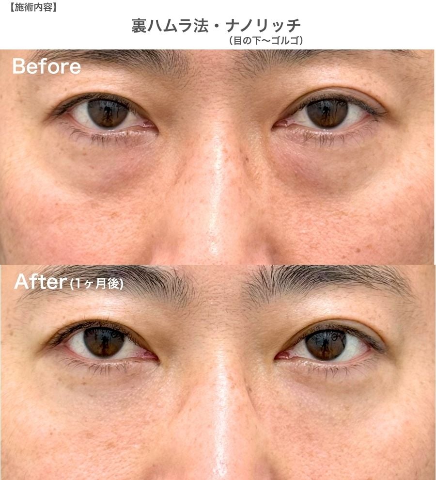 40代前半男性