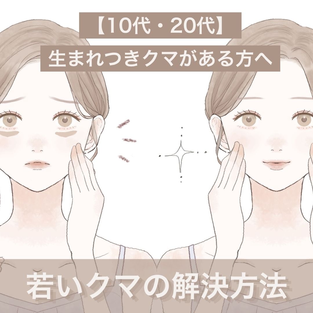 【10代・20代生まれつきのクマ】遺伝や骨格のせいと諦めないで！≪クマ取り名医≫湘南美容クリニック蒲田院・上岡利一院長が解説する「若い頃からある頑固なクマ」の根本解決法