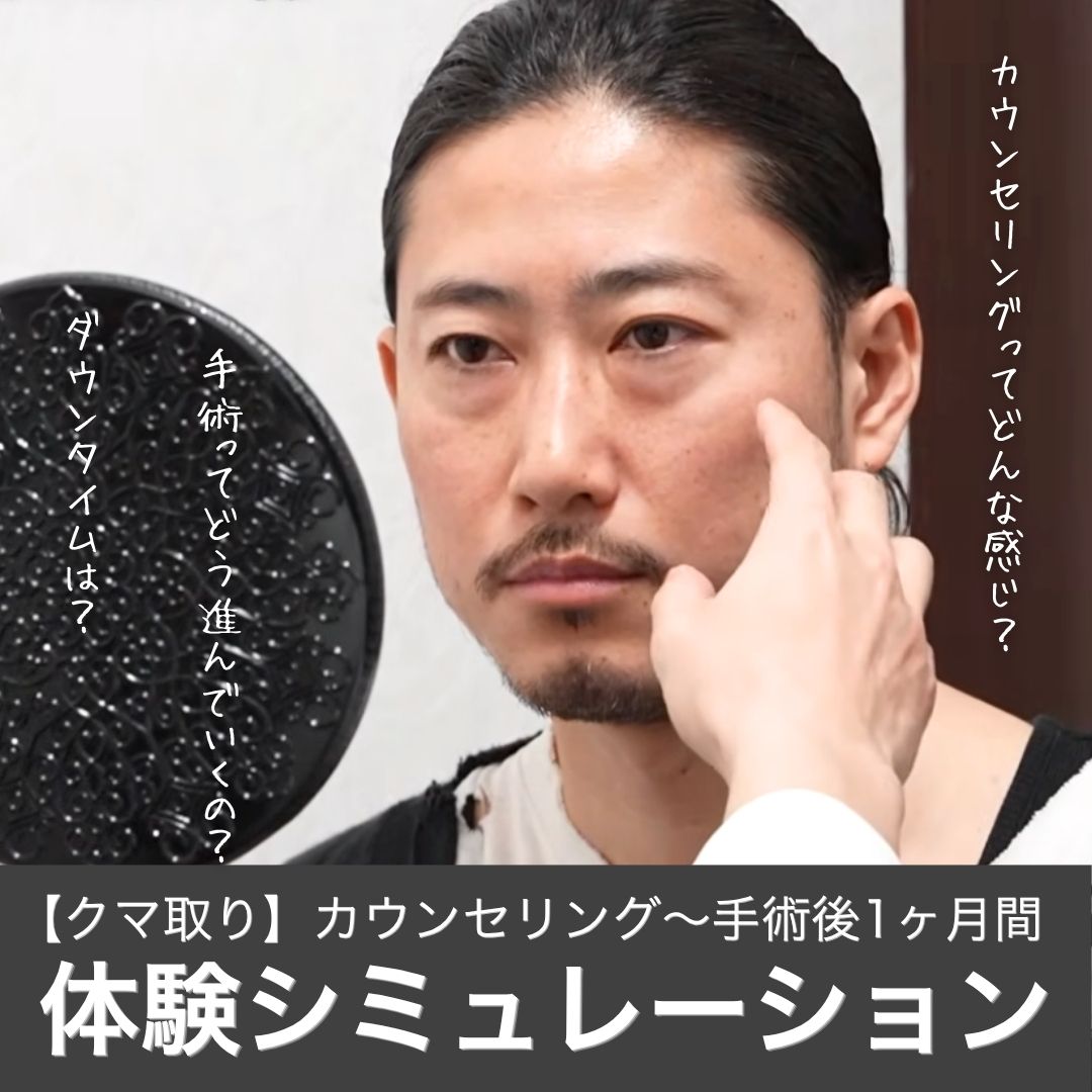 【体験シミュレーション】«クマ取り名医»湘南美容クリニック蒲田院｜上岡利一医師のクマ取りを受けるとどう変わる？