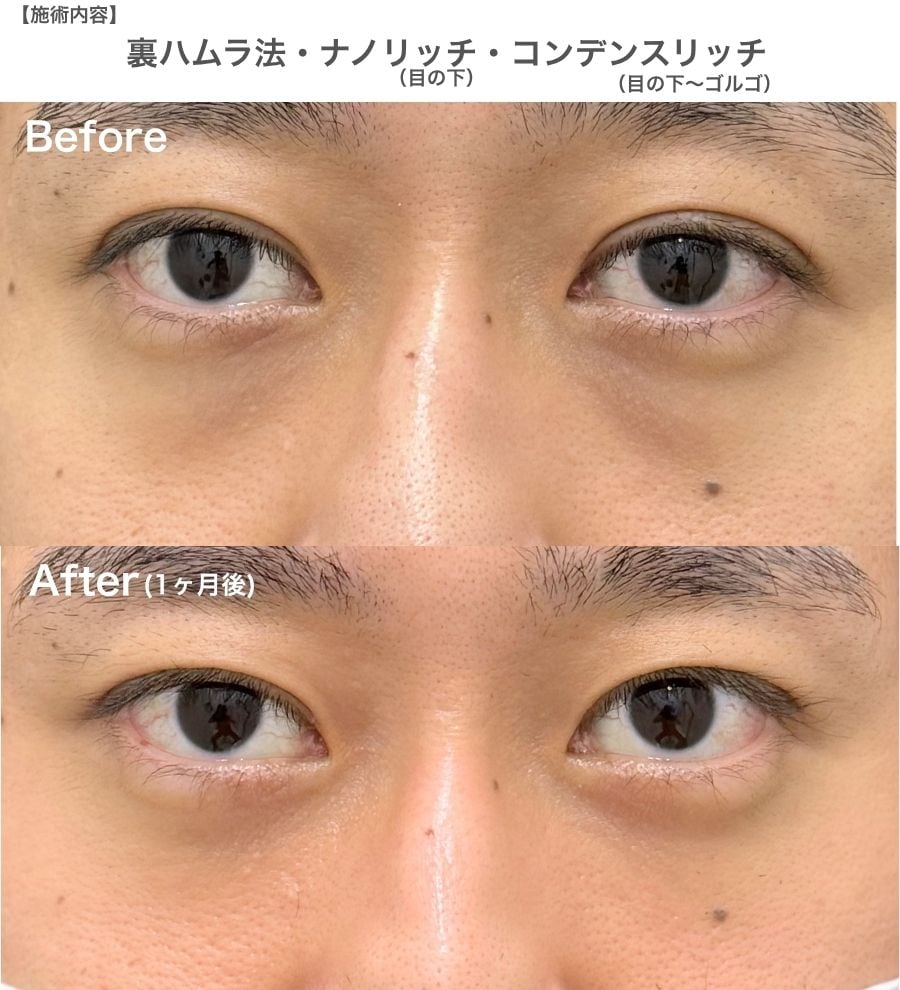 30代男性：仕事の「お疲れモード」を解消した症例
