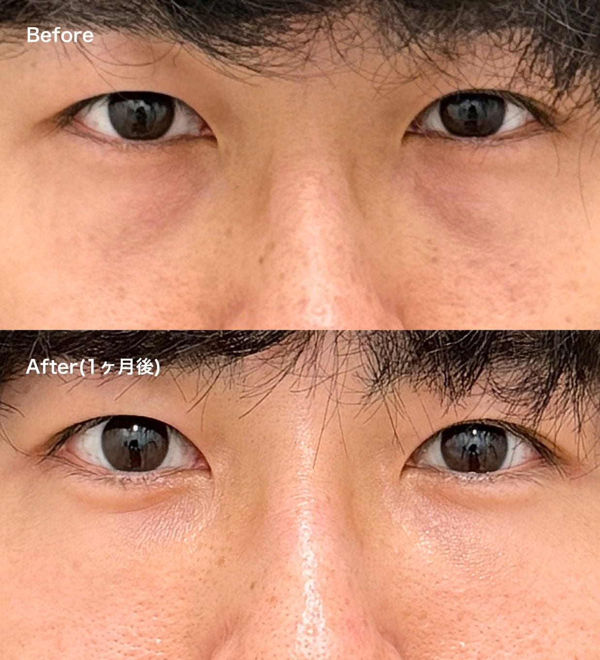 20代：疲労感の払拭とフレッシュさの獲得