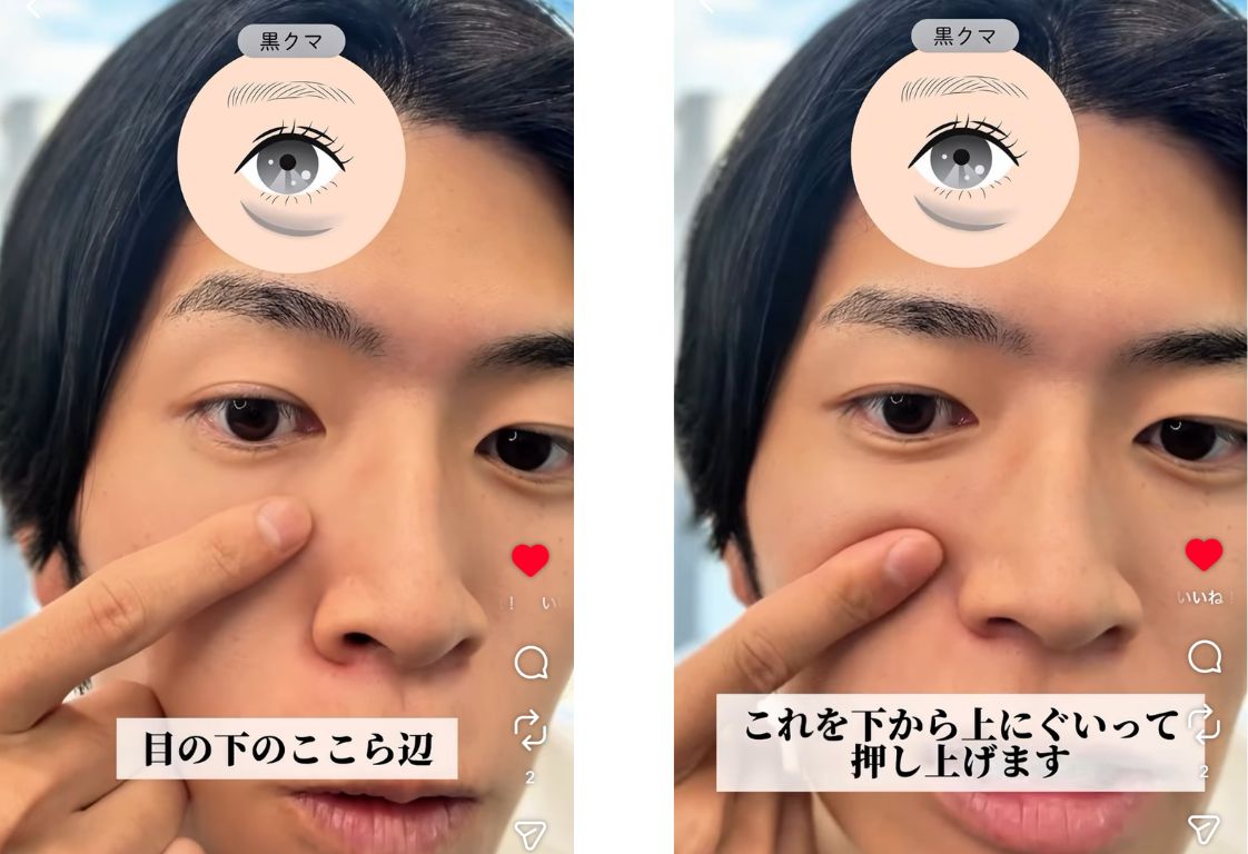 黒クマ（影クマ）