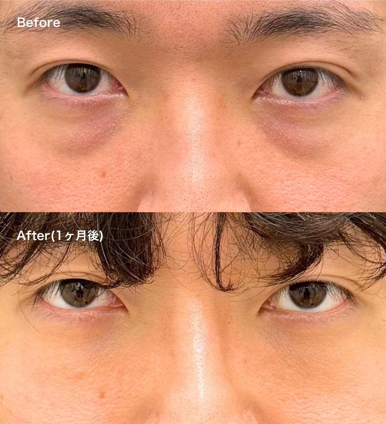 30代：仕事の「お疲れモード」を払拭。エネルギッシュな目元に