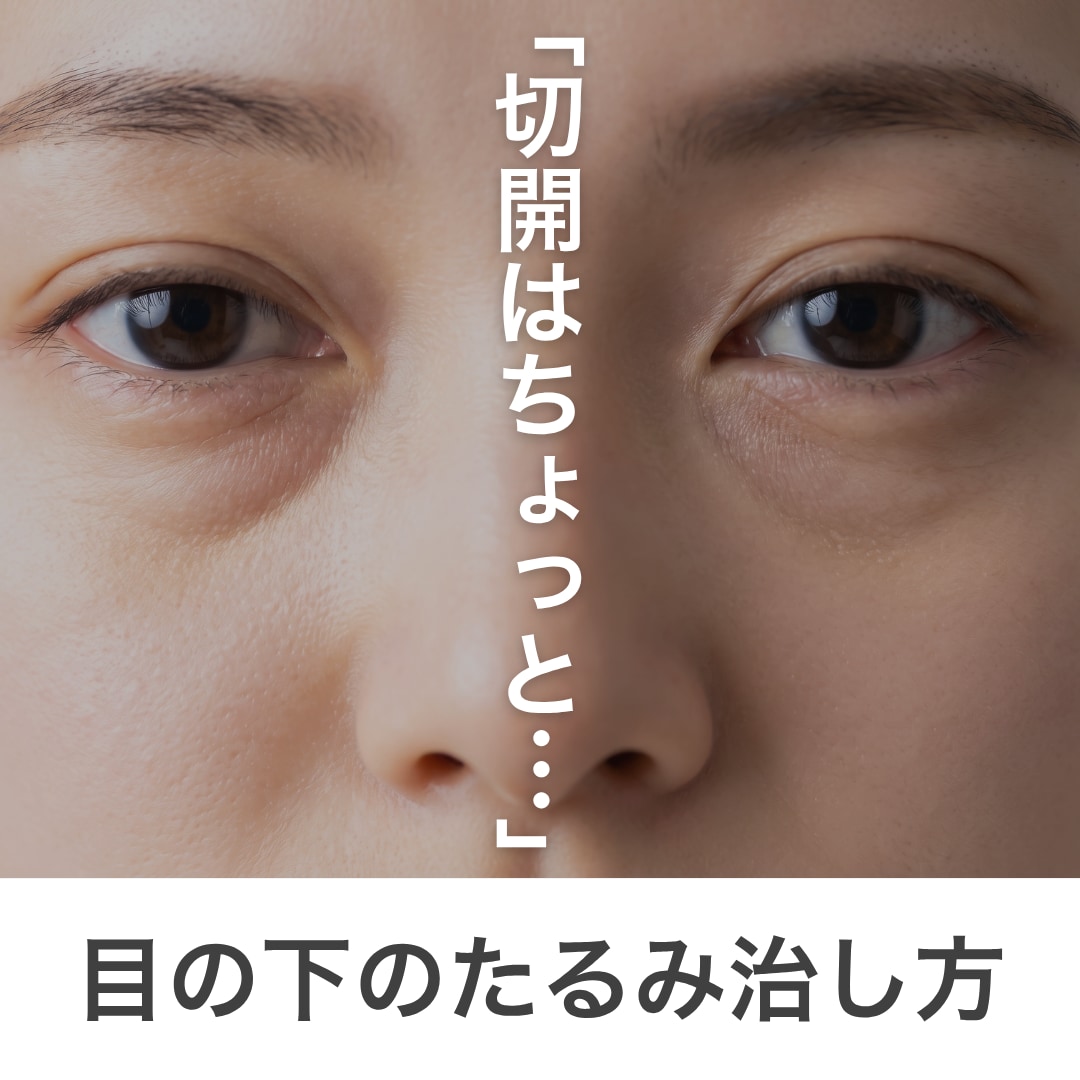 目の下のたるみは切らなくても改善できる?症状に合わせた治療の組み合わせ方
