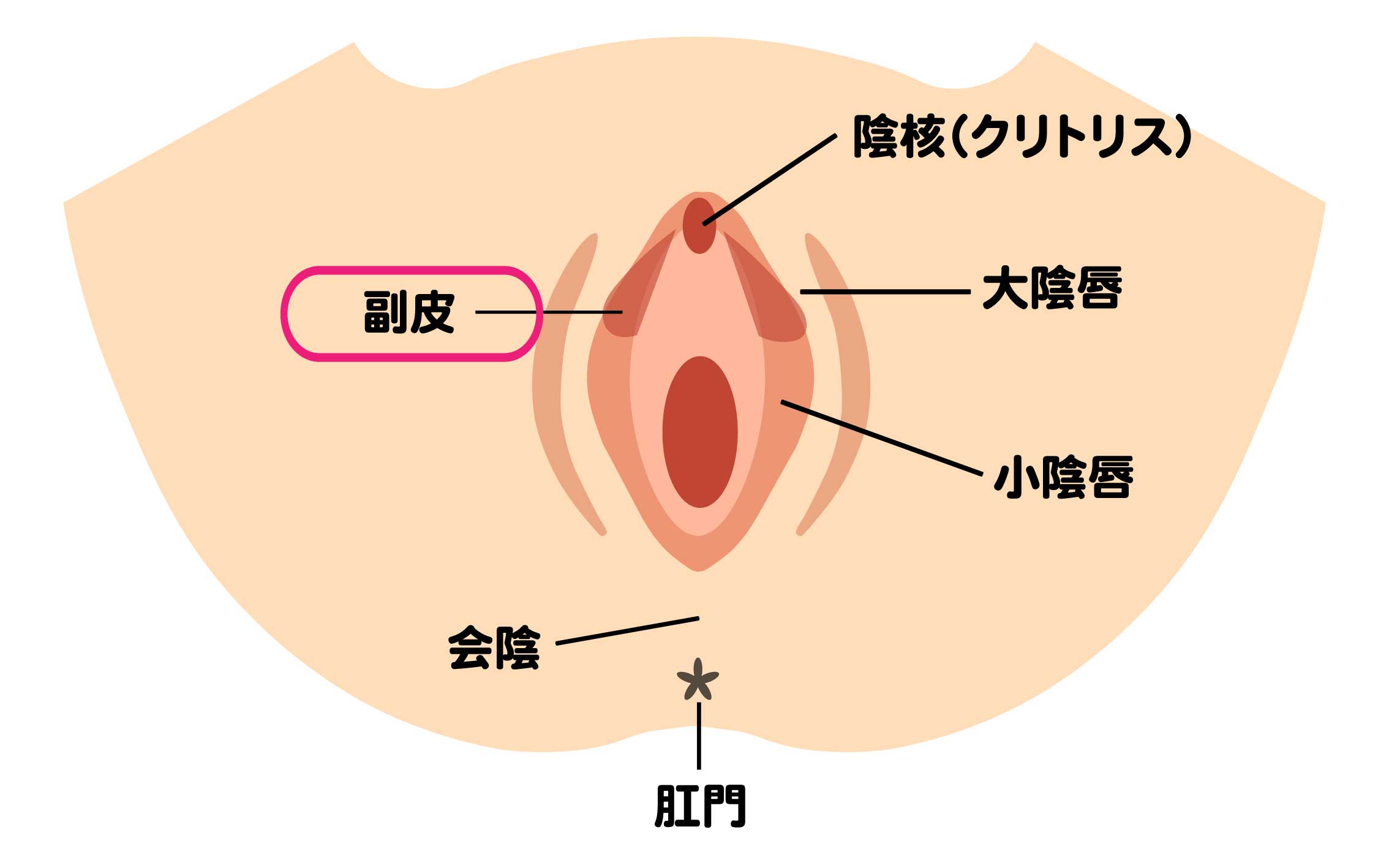 副皮除去術