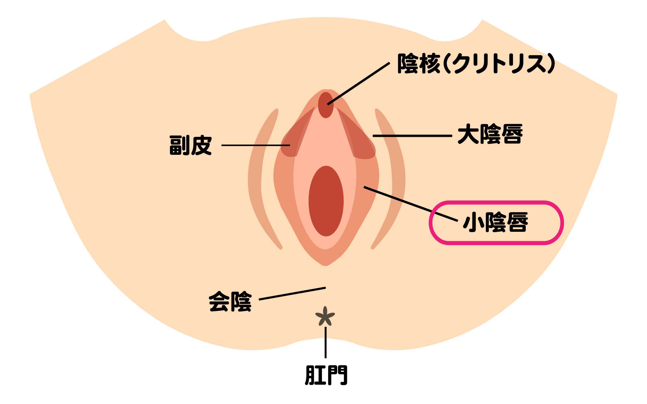 小陰唇縮小術