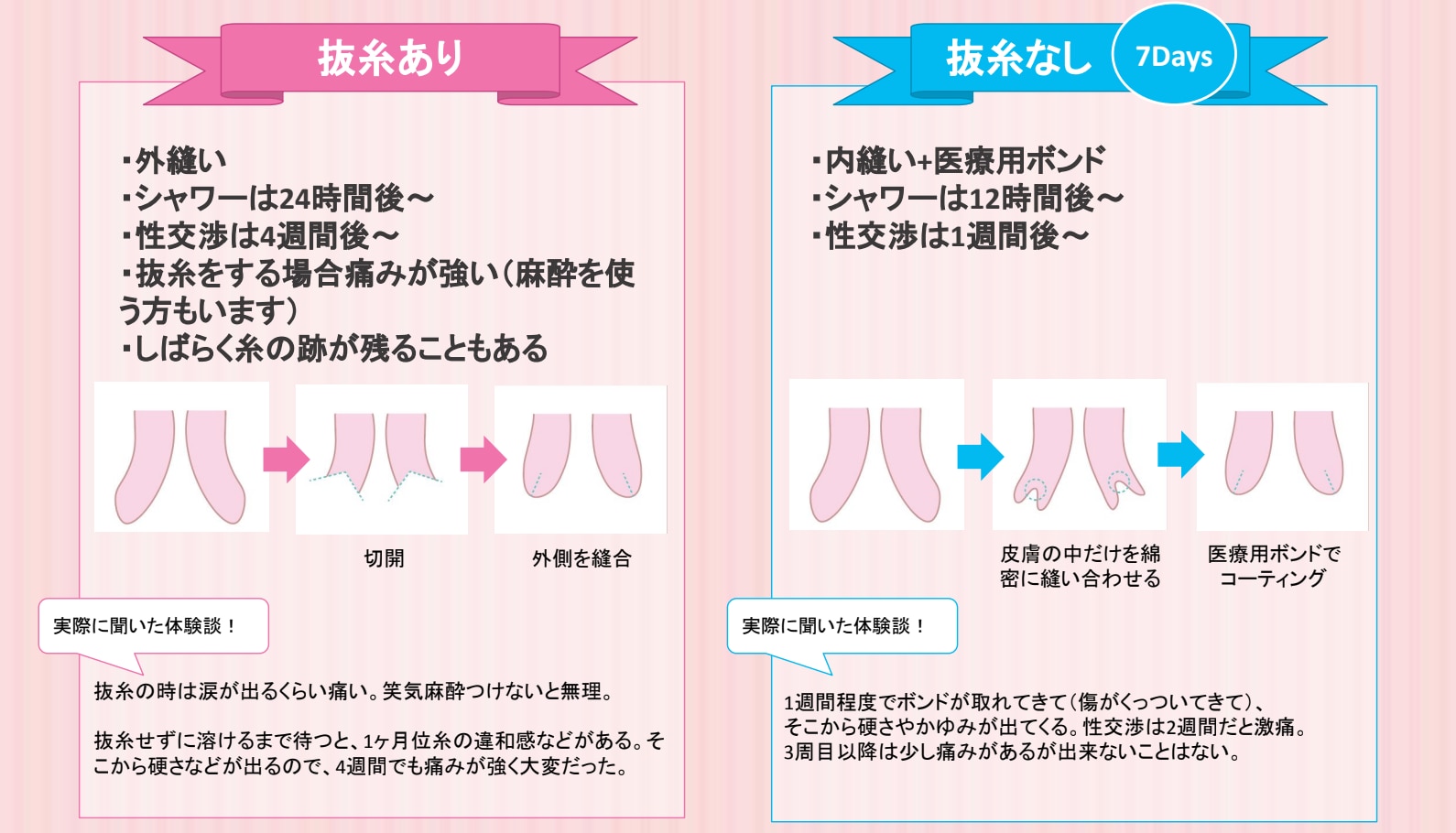 抜糸なし７days法