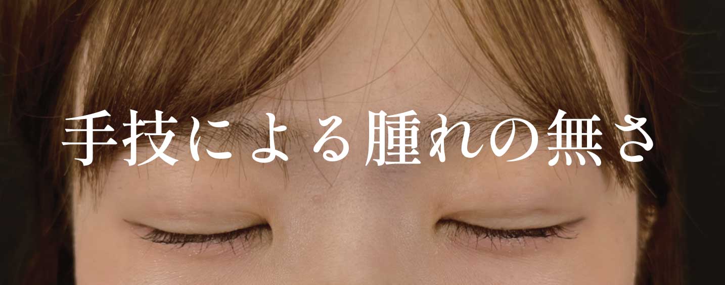 腫れや内出血の少なさ