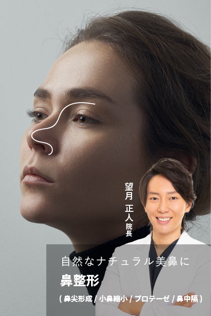 整形鼻にならない、ナチュラルを極めた理想の横顔に