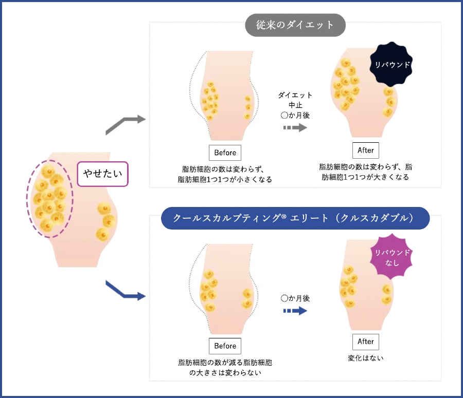 リバウンドがしにくい