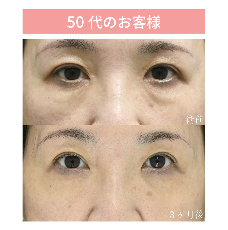 50代