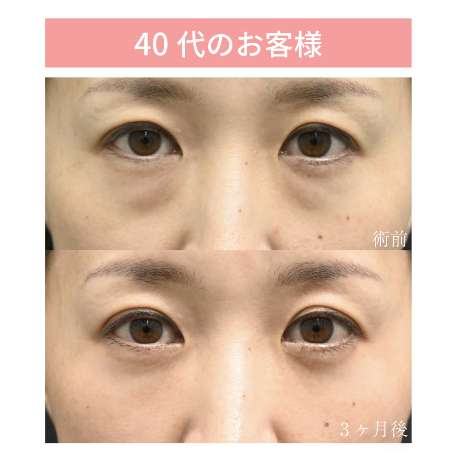 40代