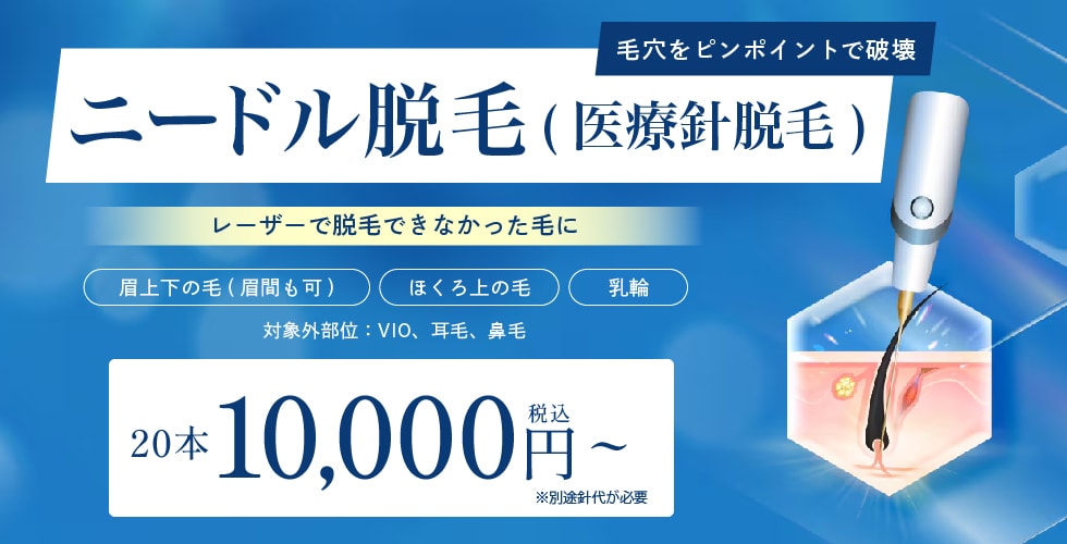 ニードル脱毛(針脱毛)