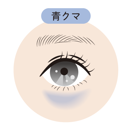 【青クマの治療】