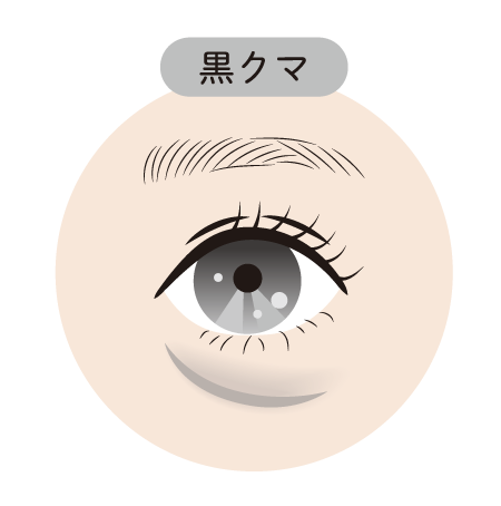 【黒クマ(影クマ)の治療】