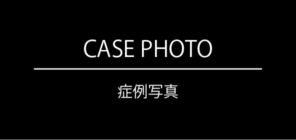 エンブレイスを使用した場合のビフォーアフター