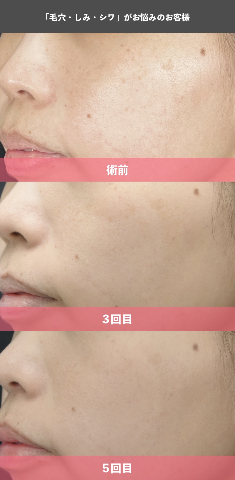 こんな肌悩みに効果を実感されています
