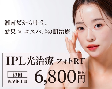 金沢でフォトフェイシャルをもっと身近に｜湘南美容クリニックのIPL光治療（フォトRF）