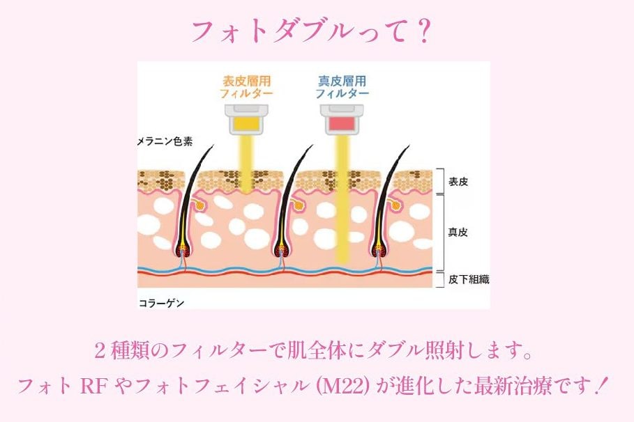 フォトダブルとは?