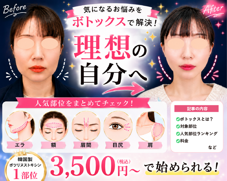 金沢で「ボトックス」するなら湘南美容クリニック！これ見たらわかる！効果・料金・副作用