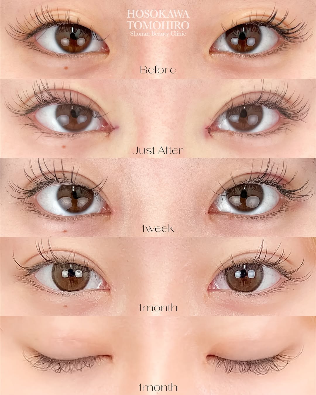 MIX×並行二重が希望のお客様