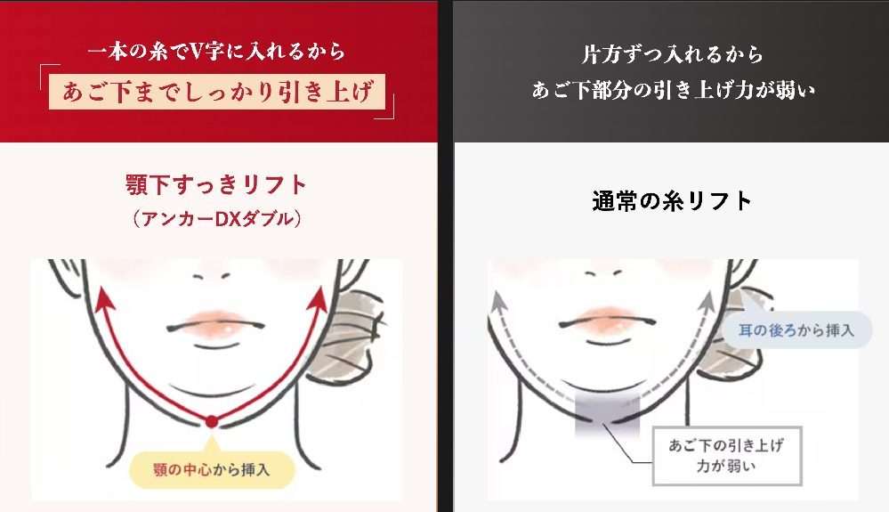 他の糸と全く違う形状