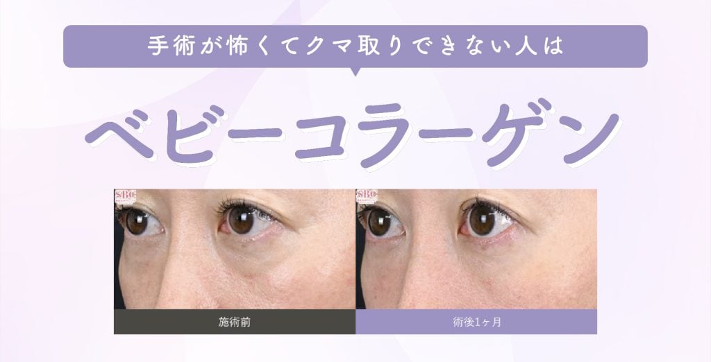 ベビーコラーゲン