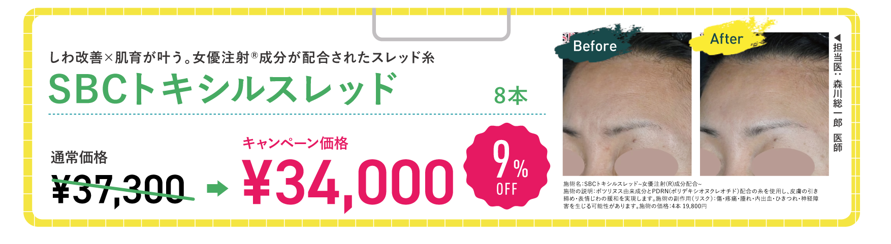 SBCトキシルスレッド