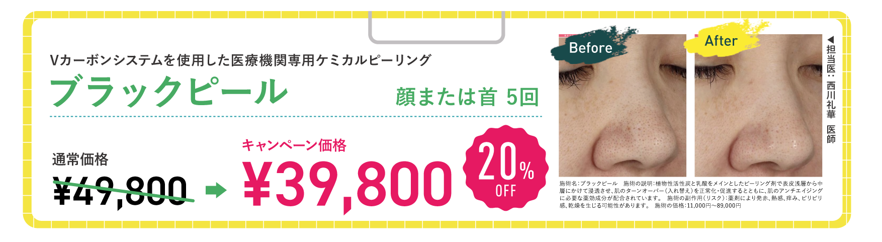 ブラックピール