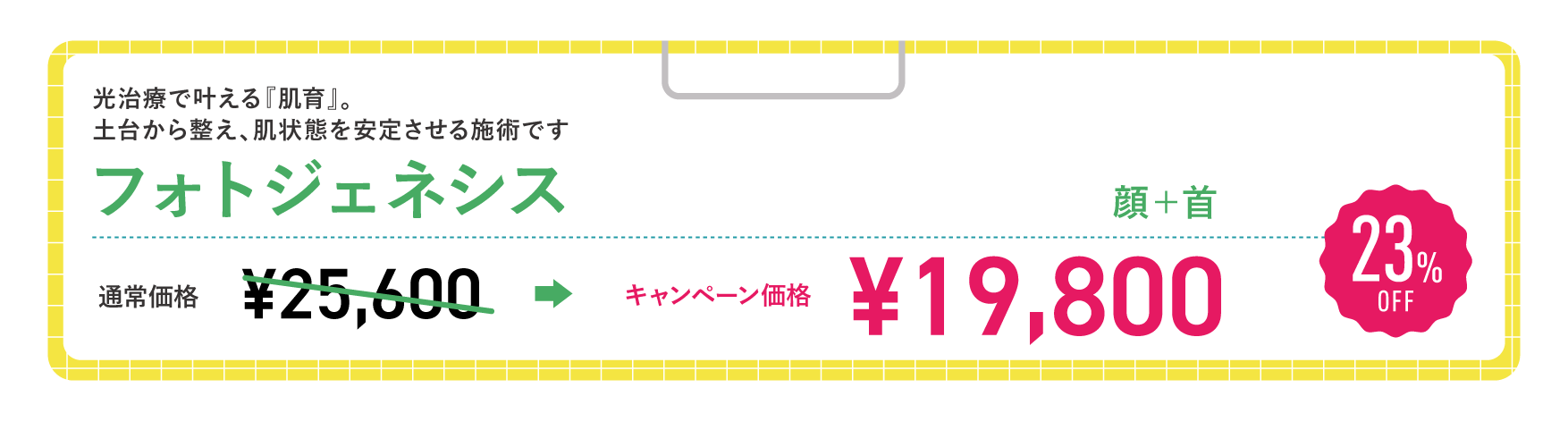 フォトジェネシス