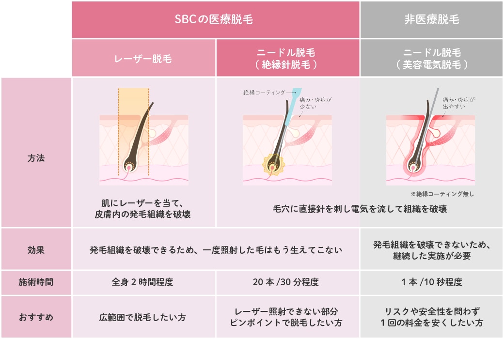 レーザー脱毛との違い