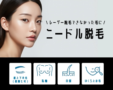 【金沢】ニードル脱毛（針脱毛）で白髪・眉毛もスッキリ！スタッフも予約待ちの人気メニューを解説