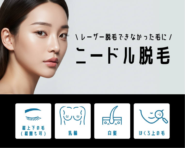 【金沢】ニードル脱毛（針脱毛）で白髪・眉毛もスッキリ！スタッフも予約待ちの人気メニューを解説