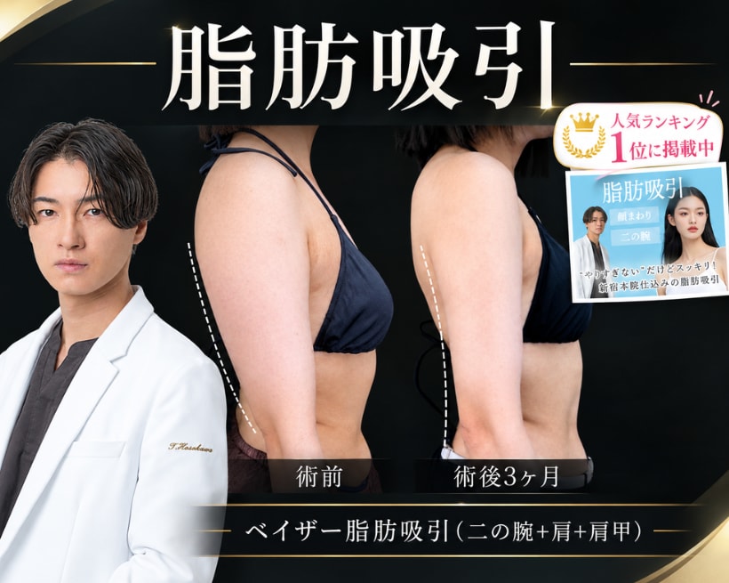 細川医師のモニター応募ランキングNo.1！人気の脂肪吸モニター絶賛募集中