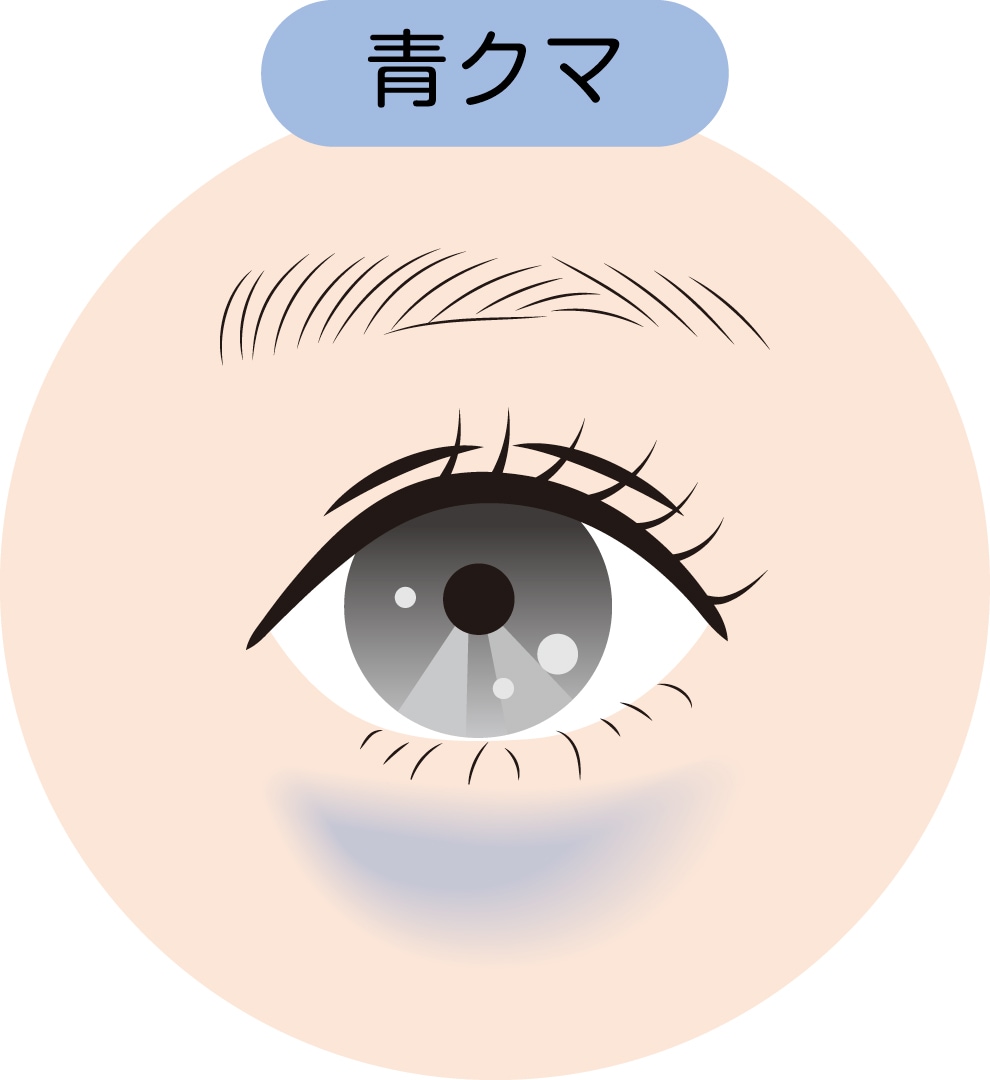 ③青クマ