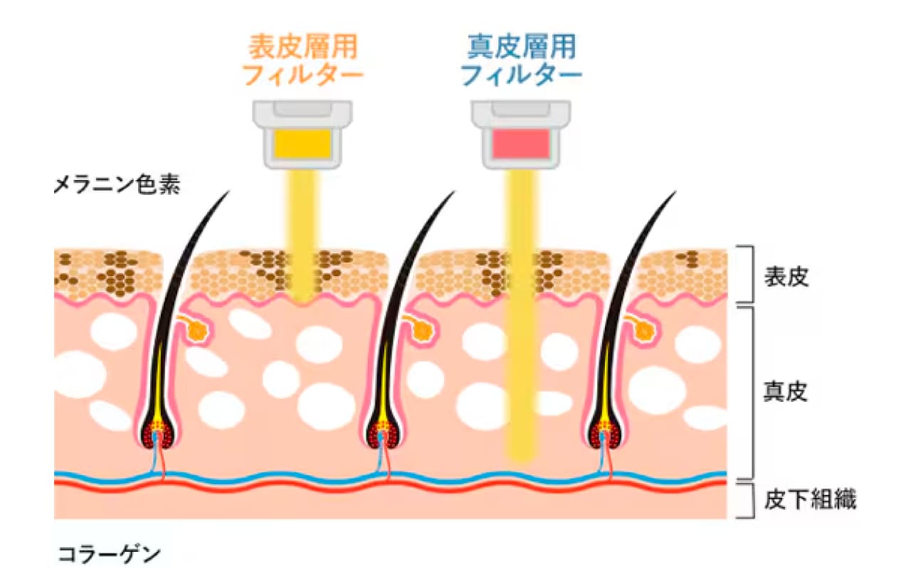 フォトダブル