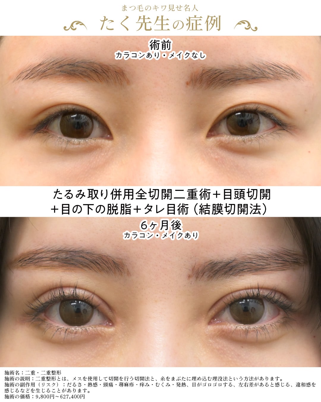 症例写真1