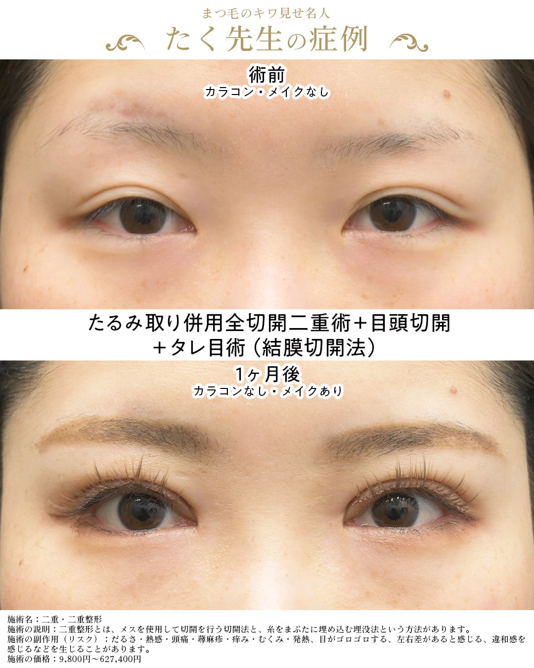 症例写真2