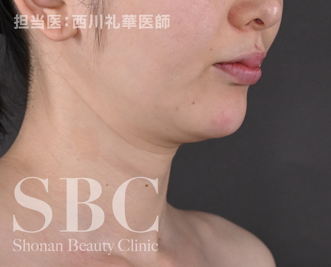 処置前
