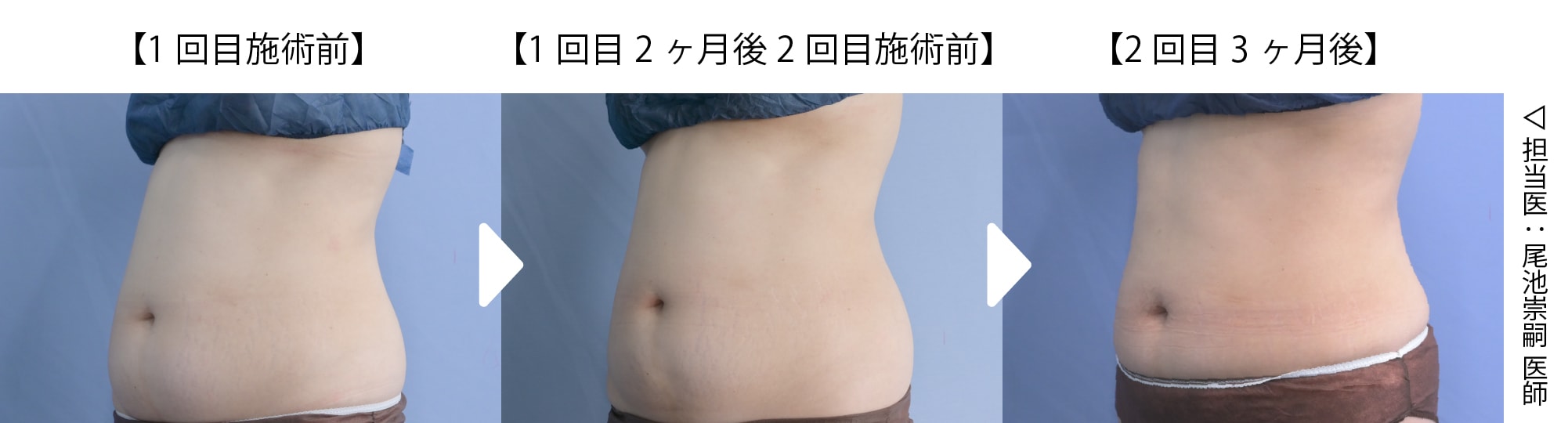 「もうちょっとお腹スッキリしたいな…」