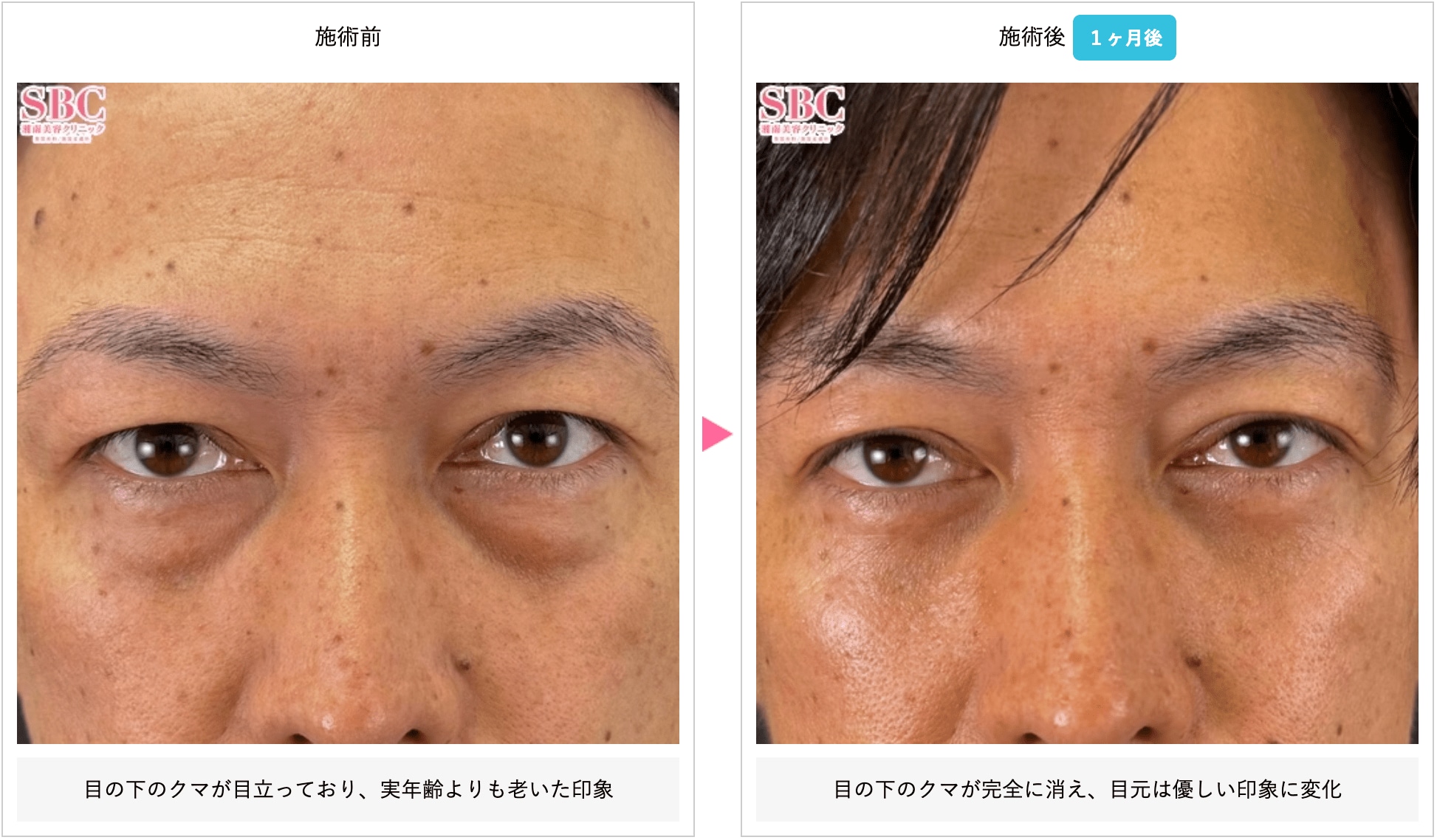 若々しい印象に
