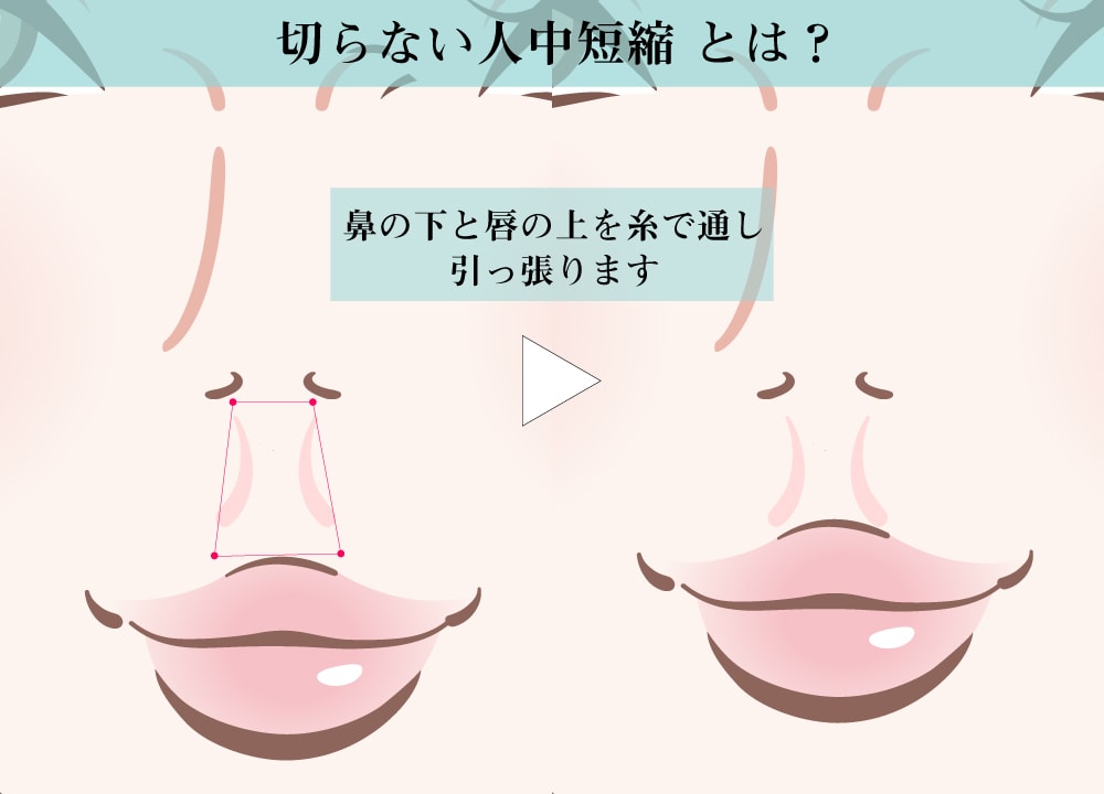 今回登場の「切らない人中短縮」