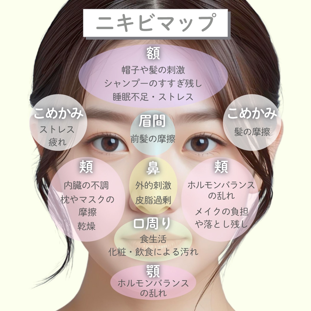 【ニキビ原因マップ】あなたのニキビはどこ？