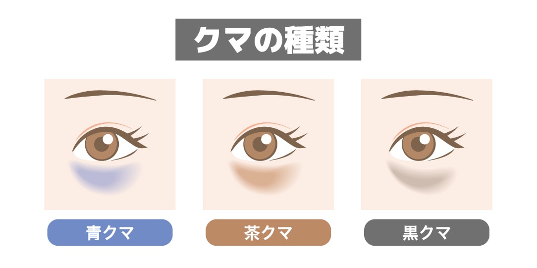 クマの見分け方