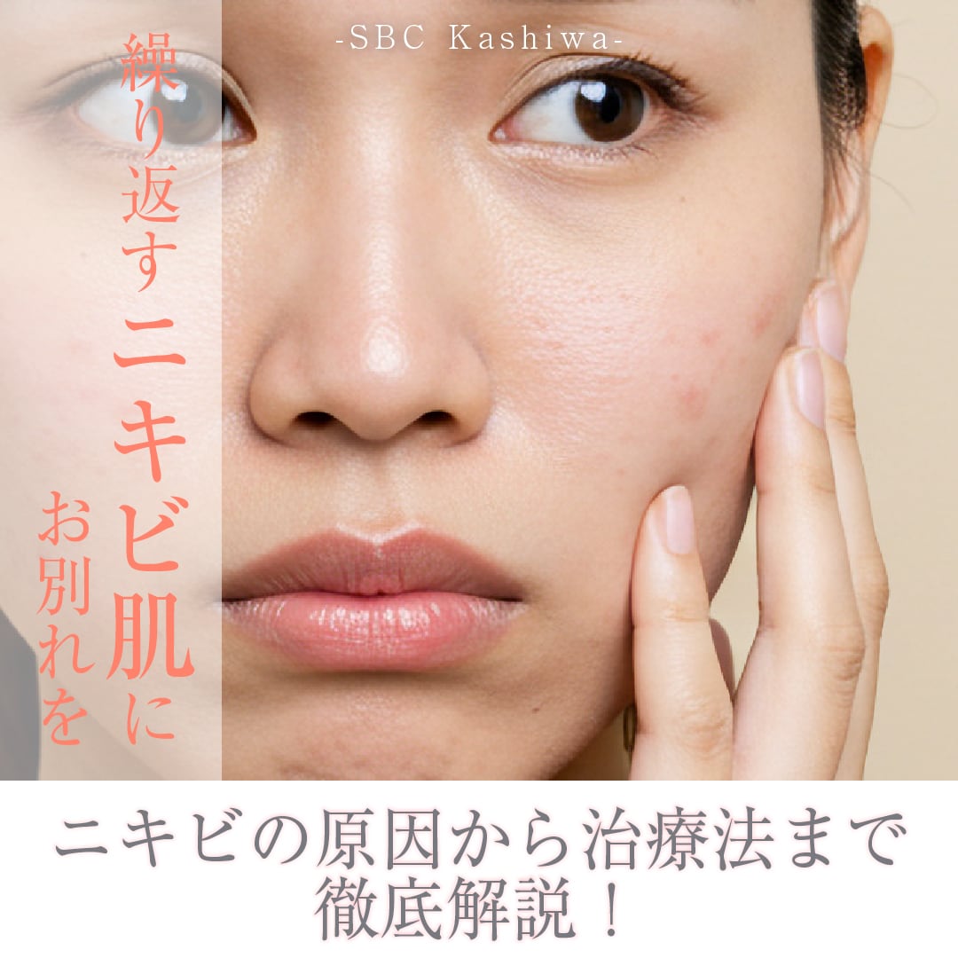 ニキビ卒業を目指すあなたへ！ニキビの原因・治療を徹底解説✨【柏院】
