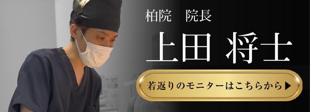 SBC柏院モニター募集はこちら