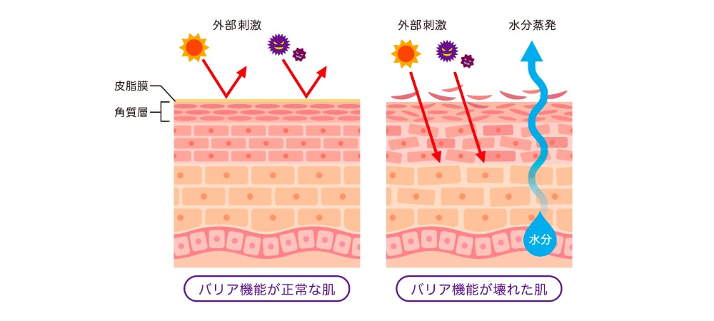花粉そのものによる「アレルギー反応」