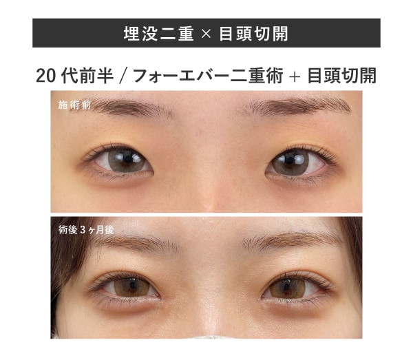 納得のいく仕上がりには、医師の「実績」が不可欠