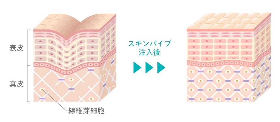 ヒミツ②：美肌の工場「線維芽細胞」を活性化